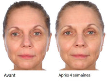 Charger l'image dans la galerie, NassifMD - Sérum Booster d’éclat à la Vitamine C