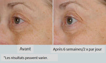 Charger l'image dans la galerie, NassifMD - Crème Yeux Revitalisante Péri-Orbital