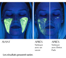 Charger l'image dans la galerie, NassifMD - Detox Pads Lingettes Perfectrices de teint - Doux