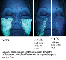 Charger l'image dans la galerie, NassifMD - Detox Pads Lingettes Perfectrices de teint - Original