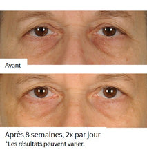 Charger l'image dans la galerie, NassifMD - Traitement Anti-Âge Lissant Pour Les Yeux